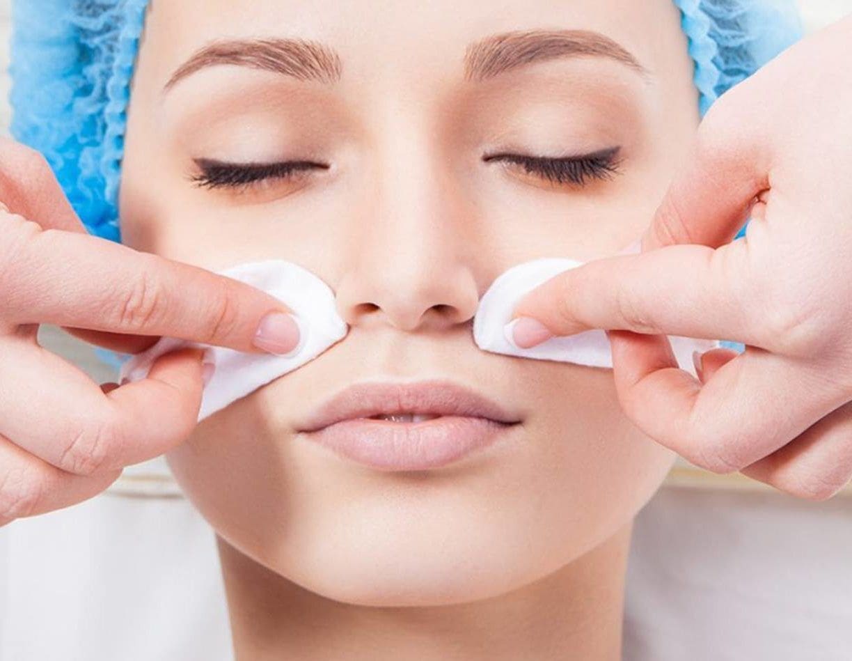 Gentle Chemical Peels for Melasma Serene Skin Health