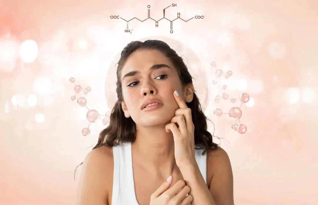 cure MELASMA glutathione