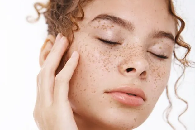 Dark Patches On Face Treatment