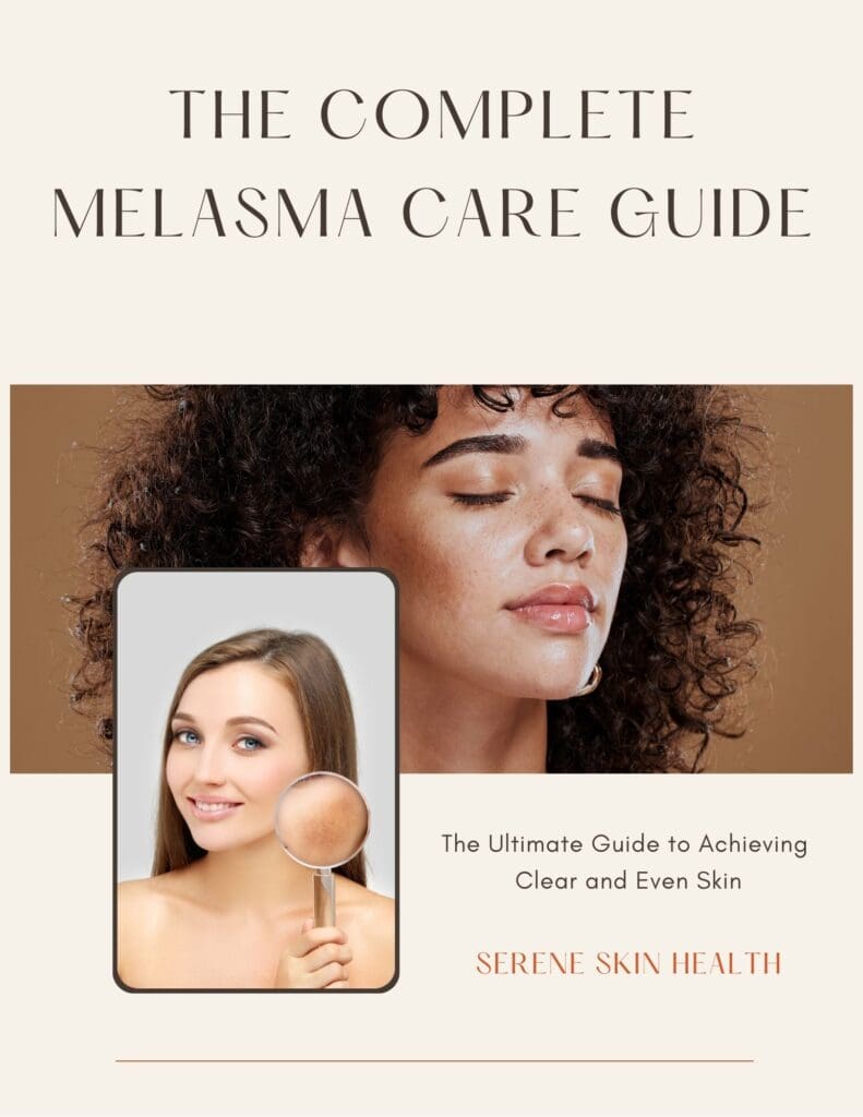 melasma ebook
