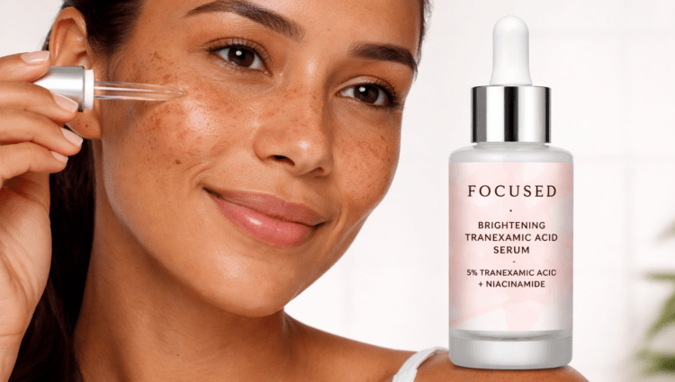 Why Tranexamic Acid Is Effective for Melasma